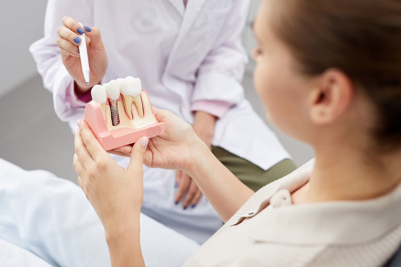 Kiedy pacjenci powinni się zdecydować na założenie implantów zębowych?